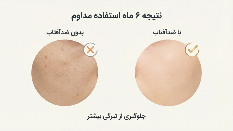 استفاده از ضد آفتاب و نقش آن بر پوست