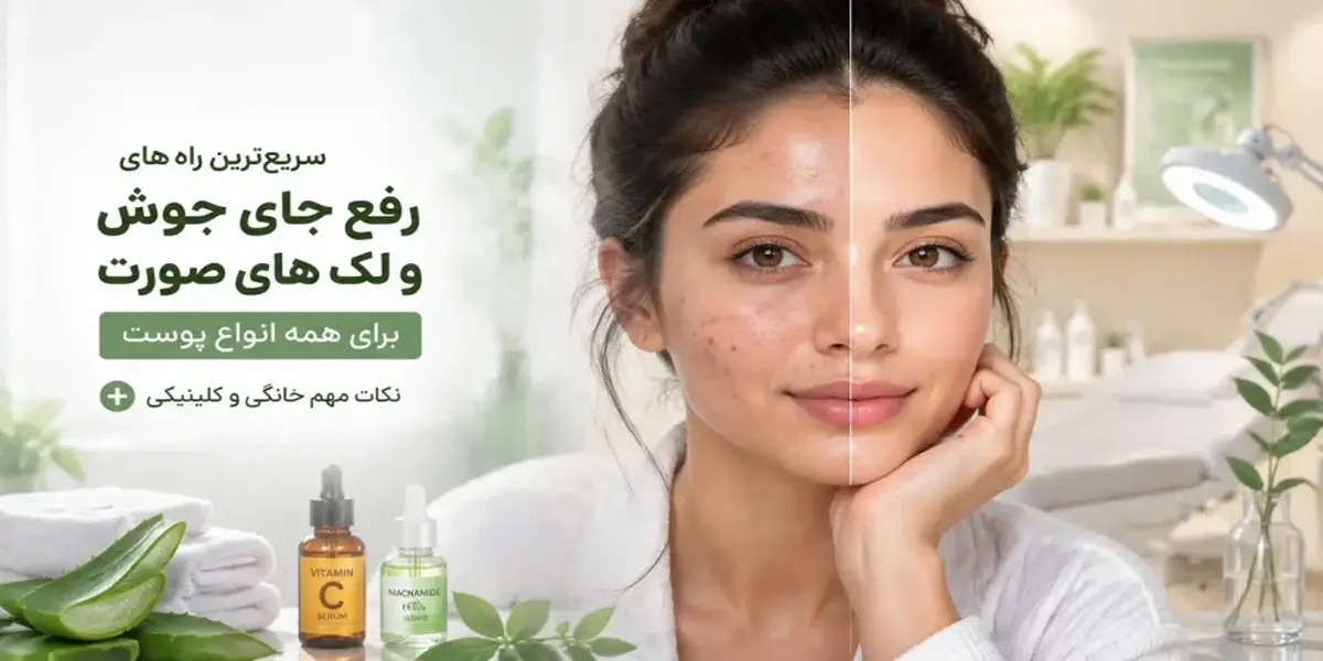 درمان جای جوش (PIH) در خانه: راهکارهای علمی
